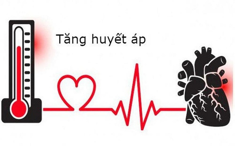 Tuyên bố của Hội Tăng huyết áp Châu Âu: “Hiện tại không có vai trò cho việc theo dõi huyết áp không có vòng bít”